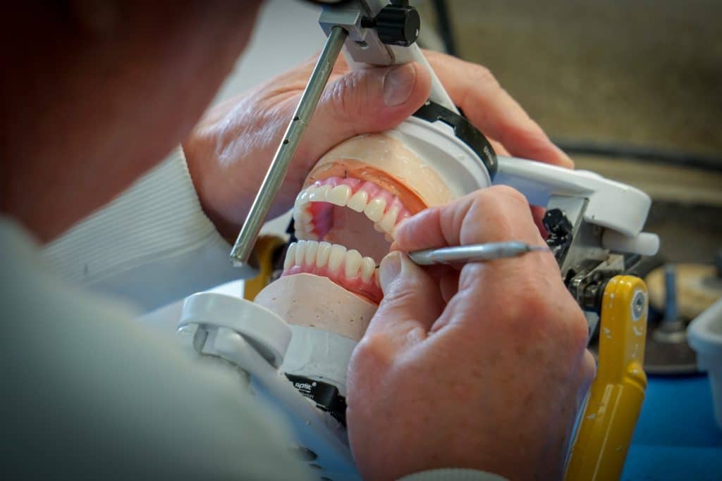 dental implants services denver